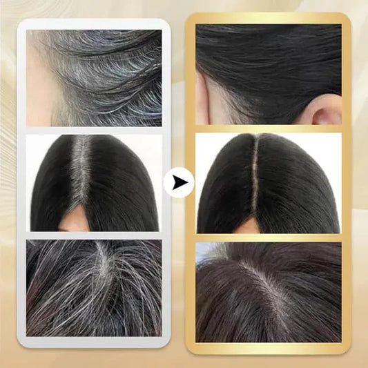 White Hair Covering is Simple and Convenient